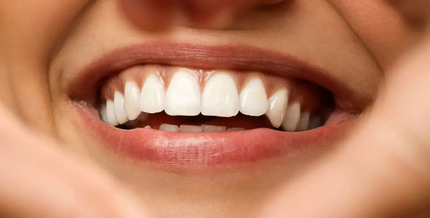 Estética dental en Miraflores con la Dra Alejandra Ulloa